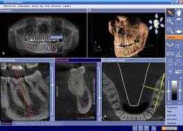 Galileos Viewer   -  3